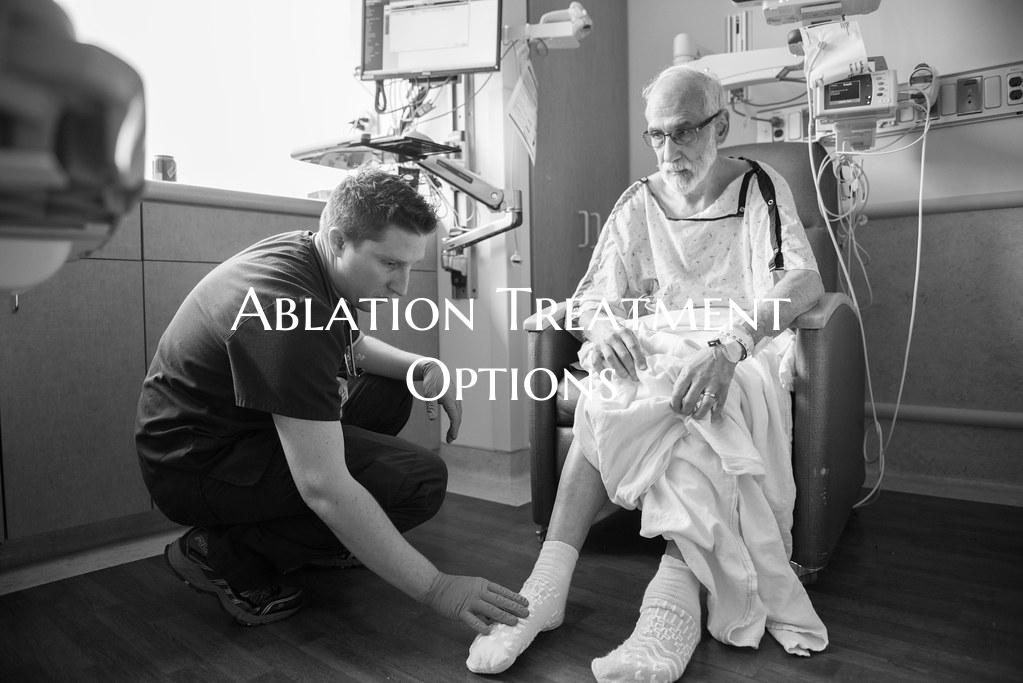 Ablation Treatment Options